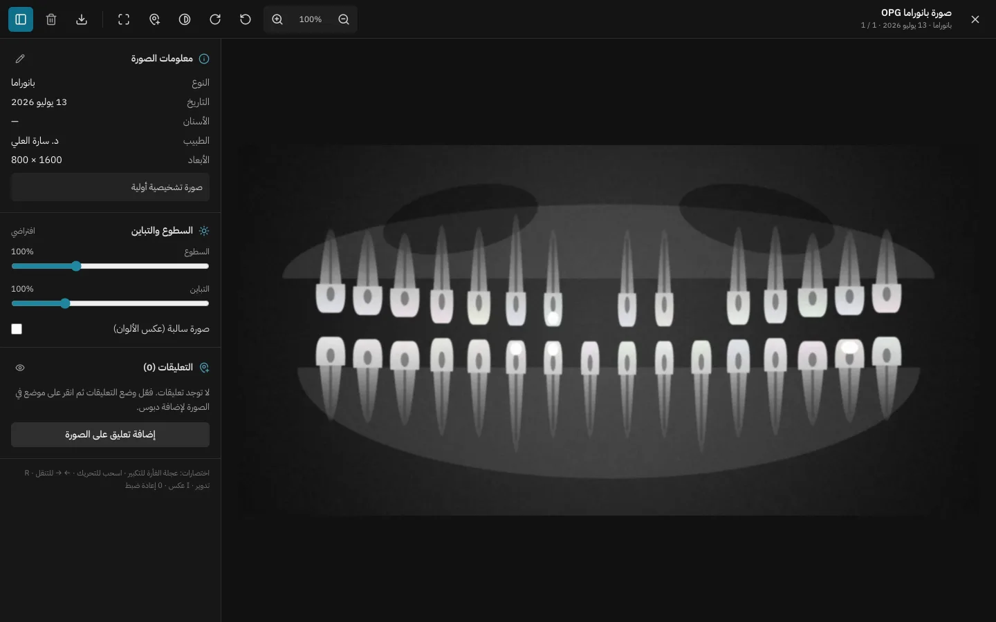 Panoramic X-ray viewer with brightness, contrast and annotation tools